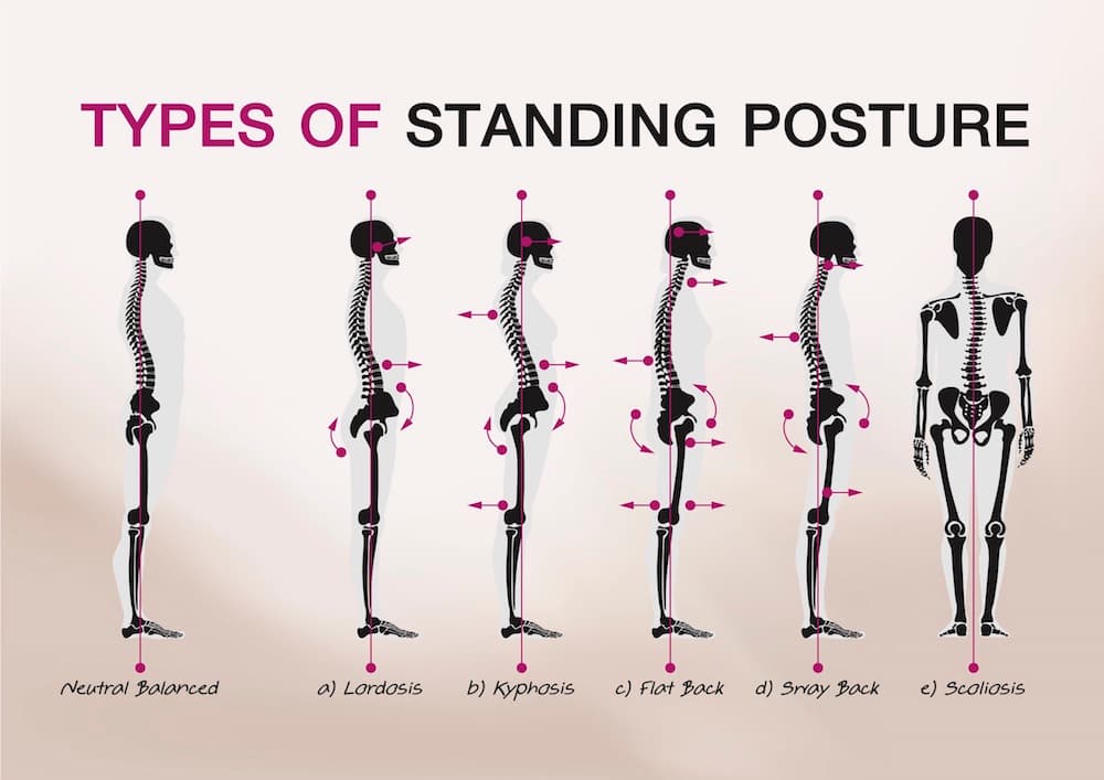 types of standing posture